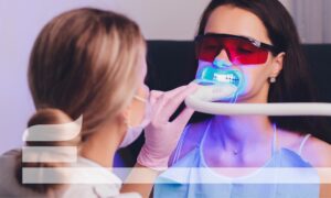 Choose the best whitening treatment.