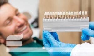 Change your smile with dental veneers.